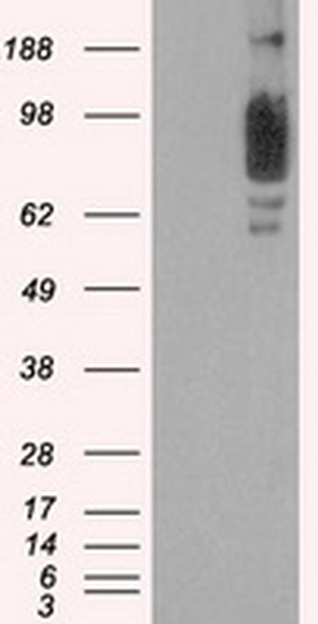 SCYL3 Antibody in Western Blot (WB)