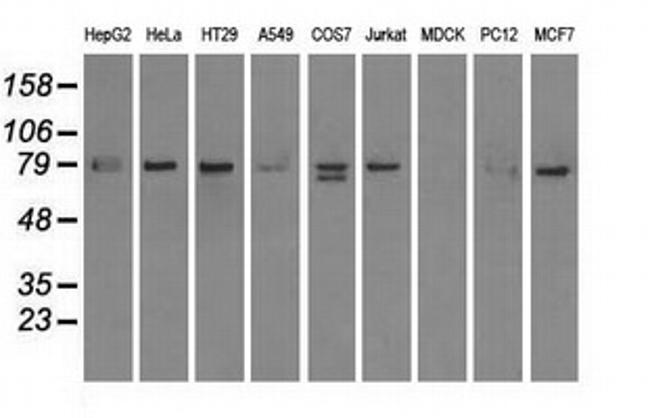 SCYL3 Antibody in Western Blot (WB)