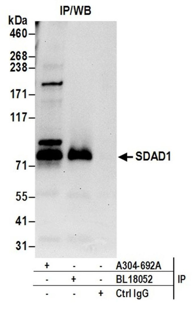 SDAD1 Antibody in Immunoprecipitation (IP)