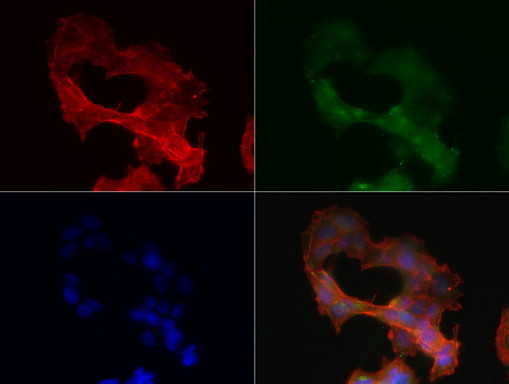 SDCBP Antibody in Immunocytochemistry (ICC/IF)