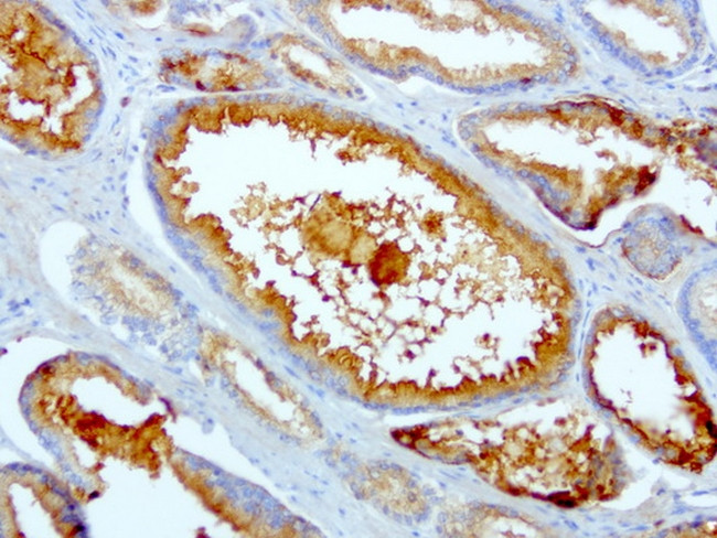 SDCBP Antibody in Immunohistochemistry (Paraffin) (IHC (P))