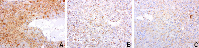 SDCBP Antibody in Immunohistochemistry (Paraffin) (IHC (P))