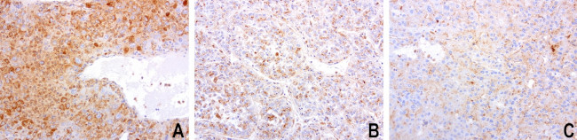 SDCBP Antibody in Immunohistochemistry (Paraffin) (IHC (P))