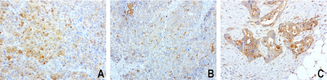 SDCBP Antibody in Immunohistochemistry (Paraffin) (IHC (P))