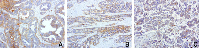 SDCBP Antibody in Immunohistochemistry (Paraffin) (IHC (P))