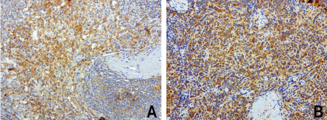 SDCBP Antibody in Immunohistochemistry (Paraffin) (IHC (P))