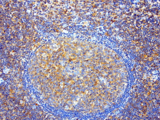 SDCBP Antibody in Immunohistochemistry (Paraffin) (IHC (P))