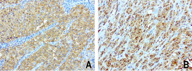 SDCBP Antibody in Immunohistochemistry (Paraffin) (IHC (P))