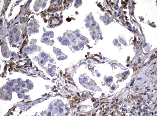 SDCBP Antibody in Immunohistochemistry (Paraffin) (IHC (P))