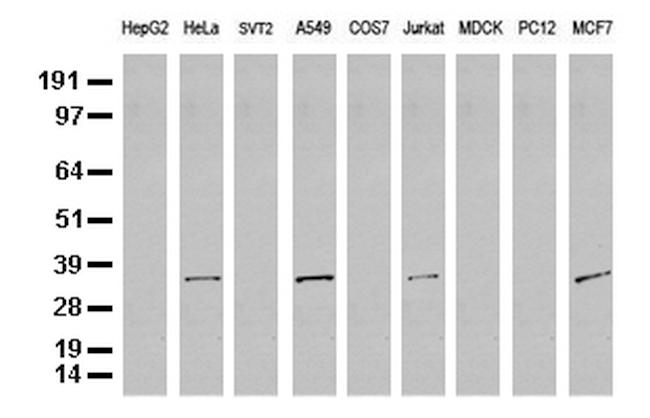 SDCBP Antibody in Western Blot (WB)