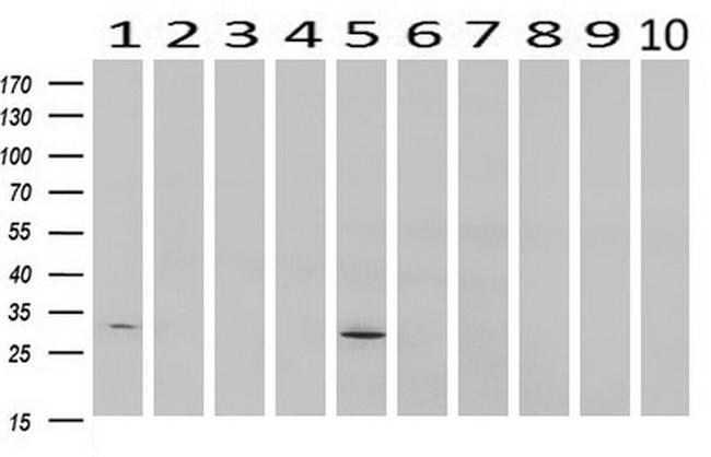 SDCBP Antibody in Western Blot (WB)