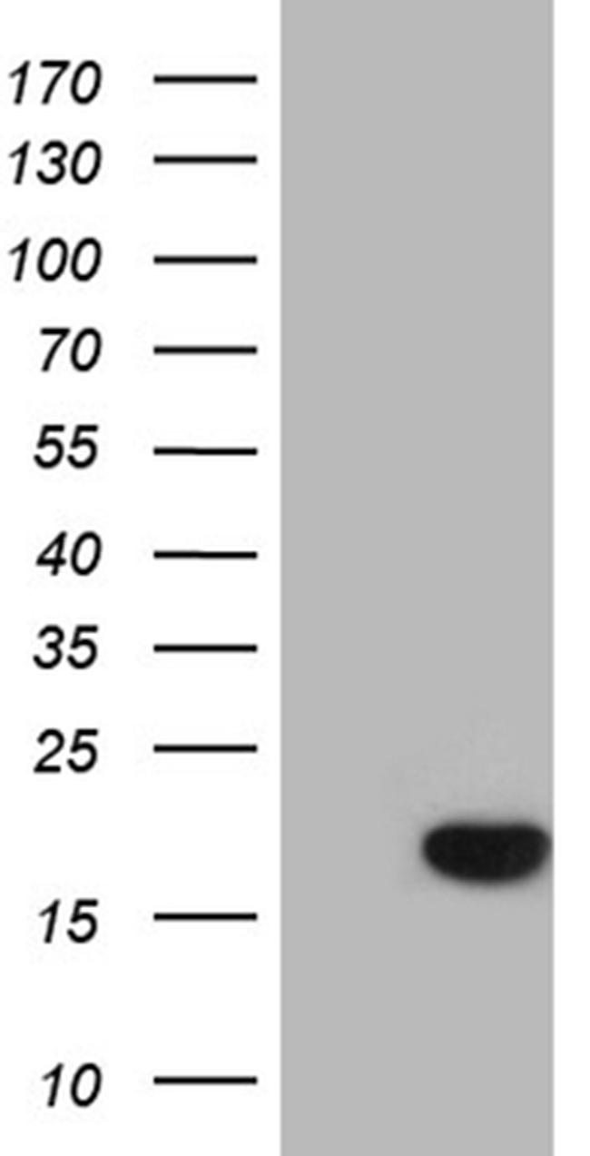 SDHAF1 Antibody in Western Blot (WB)