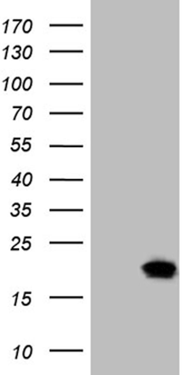 SDHAF1 Antibody in Western Blot (WB)