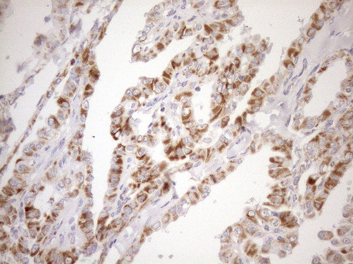 SDHB Antibody in Immunohistochemistry (Paraffin) (IHC (P))