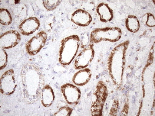 SDHB Antibody in Immunohistochemistry (Paraffin) (IHC (P))