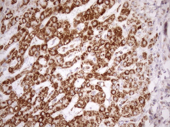 SDHB Antibody in Immunohistochemistry (Paraffin) (IHC (P))