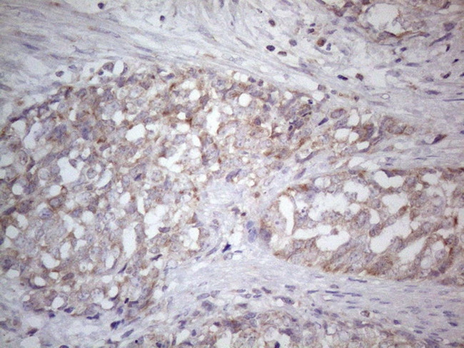 SDHB Antibody in Immunohistochemistry (Paraffin) (IHC (P))