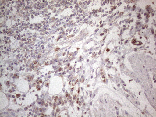 SDHB Antibody in Immunohistochemistry (Paraffin) (IHC (P))