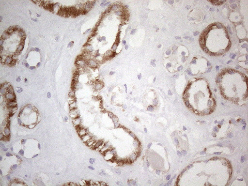 SDHB Antibody in Immunohistochemistry (Paraffin) (IHC (P))