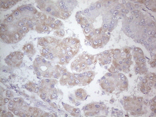 SDHB Antibody in Immunohistochemistry (Paraffin) (IHC (P))