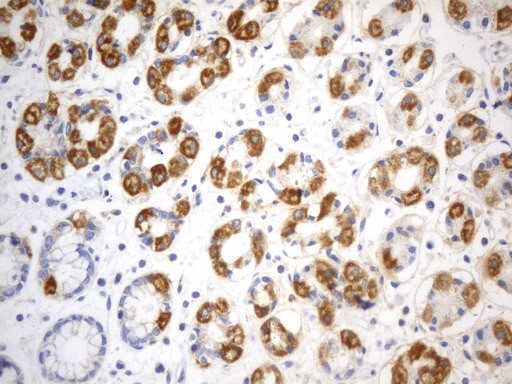 SDHB Antibody in Immunohistochemistry (Paraffin) (IHC (P))