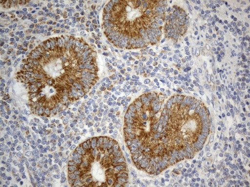 SDHB Antibody in Immunohistochemistry (Paraffin) (IHC (P))