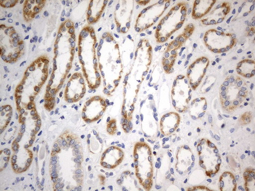 SDHB Antibody in Immunohistochemistry (Paraffin) (IHC (P))