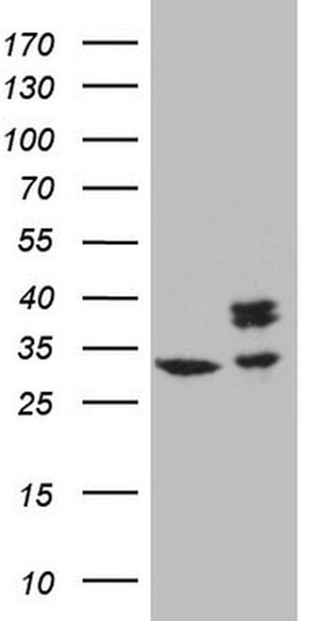 SDHB Antibody in Western Blot (WB)