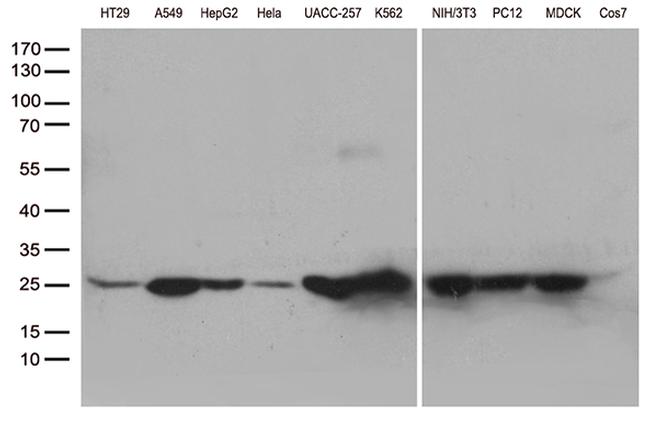 SDHB Antibody in Western Blot (WB)