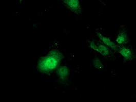 SDS Antibody in Immunocytochemistry (ICC/IF)