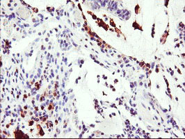 SDS Antibody in Immunohistochemistry (Paraffin) (IHC (P))