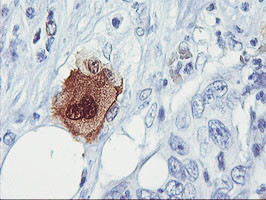 SDS Antibody in Immunohistochemistry (Paraffin) (IHC (P))