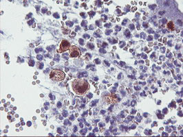 SDS Antibody in Immunohistochemistry (Paraffin) (IHC (P))