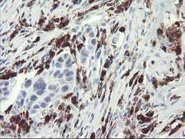 SDS Antibody in Immunohistochemistry (Paraffin) (IHC (P))