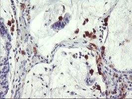 SDS Antibody in Immunohistochemistry (Paraffin) (IHC (P))