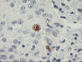 SDS Antibody in Immunohistochemistry (Paraffin) (IHC (P))