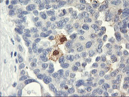 SDS Antibody in Immunohistochemistry (Paraffin) (IHC (P))