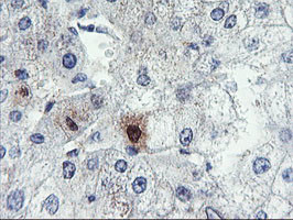 SDS Antibody in Immunohistochemistry (Paraffin) (IHC (P))