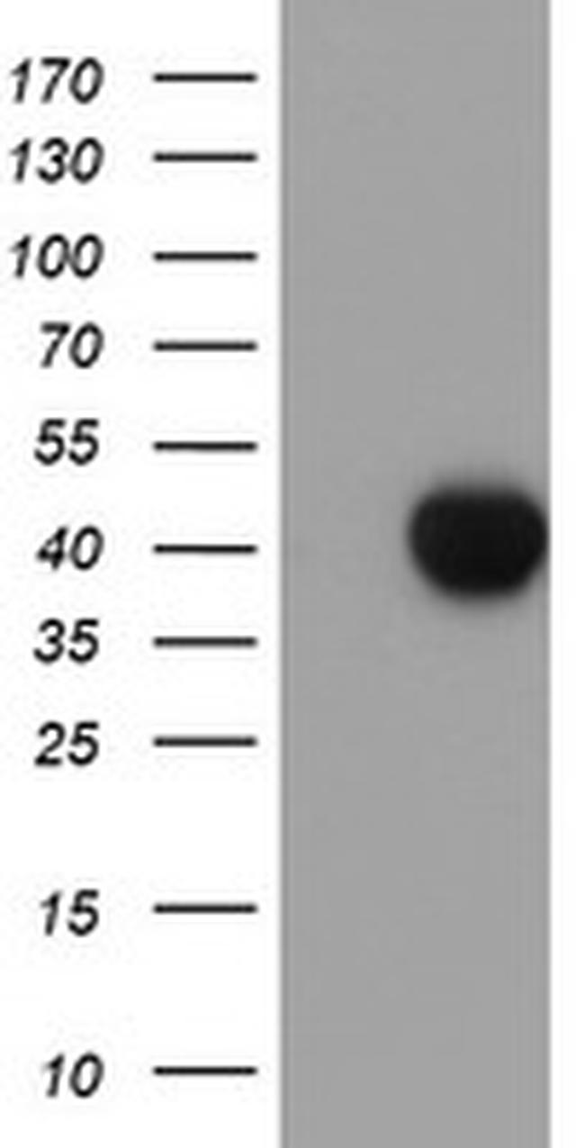 SDS Antibody in Western Blot (WB)