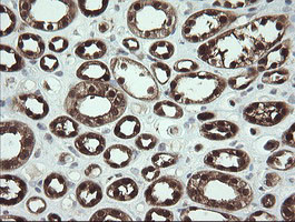 SDSL Antibody in Immunohistochemistry (Paraffin) (IHC (P))