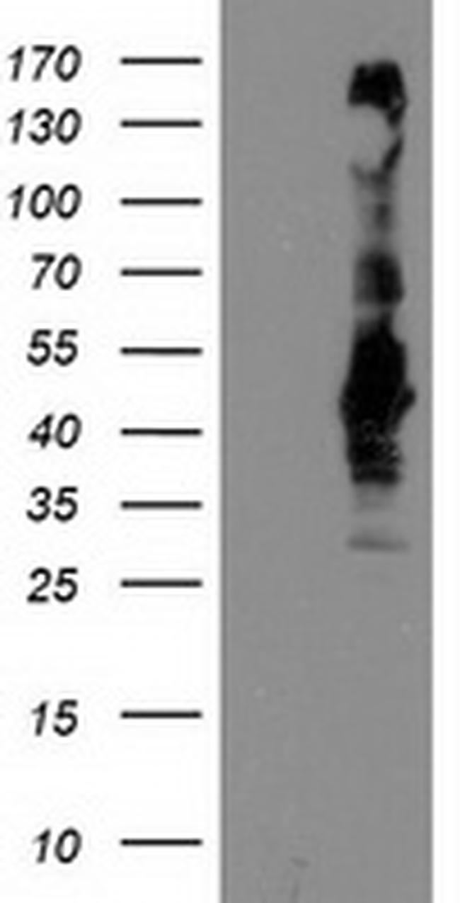 SEC14L2 Antibody in Western Blot (WB)