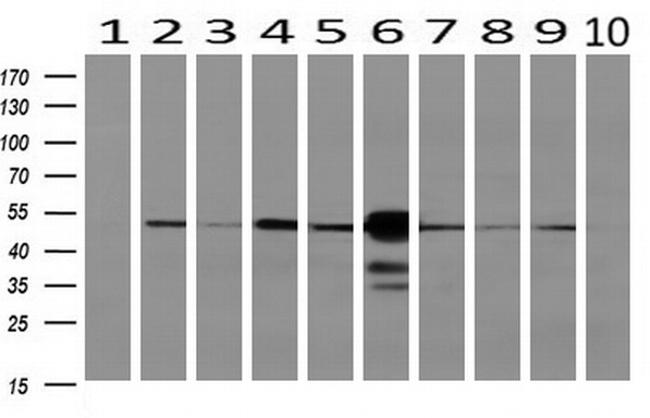 SEC14L2 Antibody in Western Blot (WB)