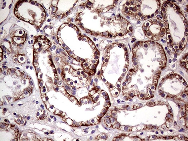 SEMA4D Antibody in Immunohistochemistry (Paraffin) (IHC (P))