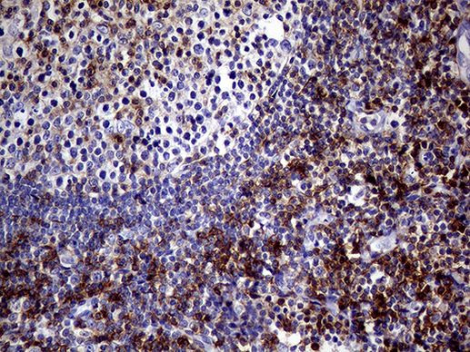 SEMA4D Antibody in Immunohistochemistry (Paraffin) (IHC (P))