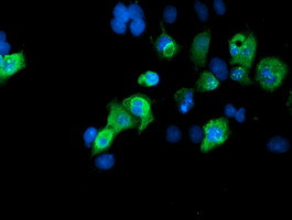 SENP2 Antibody in Immunocytochemistry (ICC/IF)