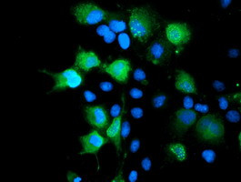 SENP2 Antibody in Immunocytochemistry (ICC/IF)