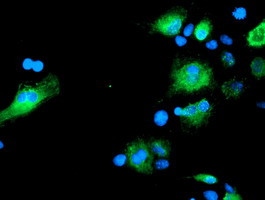 SENP2 Antibody in Immunocytochemistry (ICC/IF)