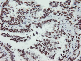 SENP2 Antibody in Immunohistochemistry (Paraffin) (IHC (P))