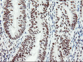 SENP2 Antibody in Immunohistochemistry (Paraffin) (IHC (P))