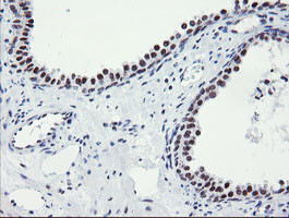 SENP2 Antibody in Immunohistochemistry (Paraffin) (IHC (P))